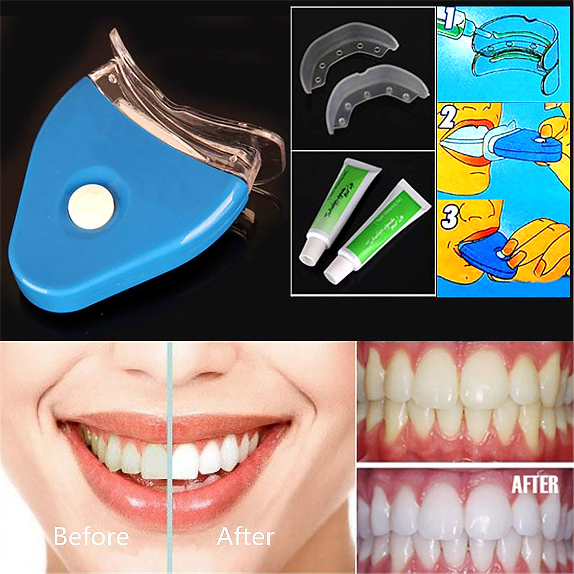 Aureli- Blue Light Tooth Whitening Dental Bleaching LED